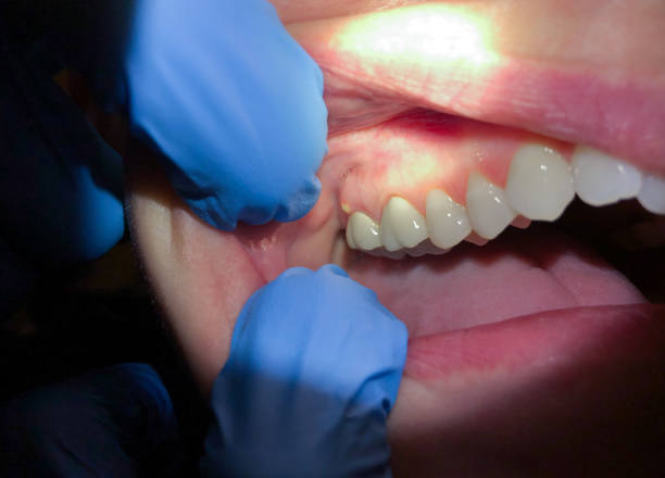 Best Emergency Cosmetic Dentistry in Haslett, MI