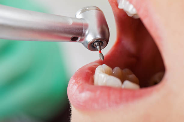 Best Pediatric Emergency Dentist in Haslett, MI